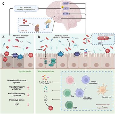 The role of potential probiotic strains Lactobacillus reuteri in various intestinal diseases: New roles for an old player